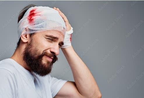 Head Injury