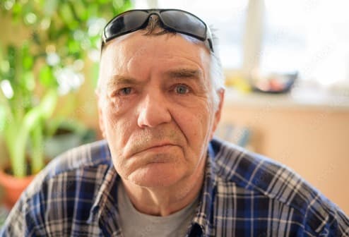 Bell's Palsy
